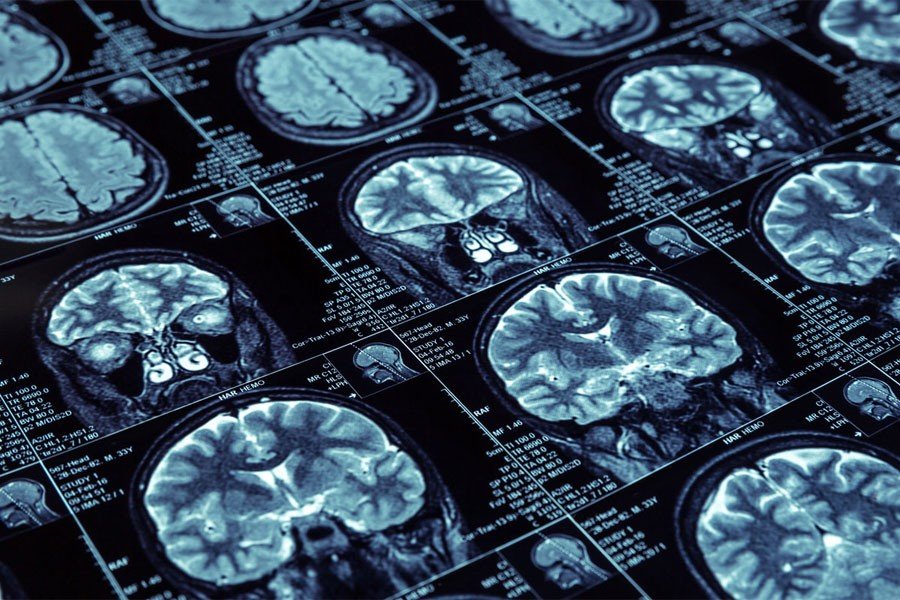 adES HealthPro Inversión adES HealthPro Inversión